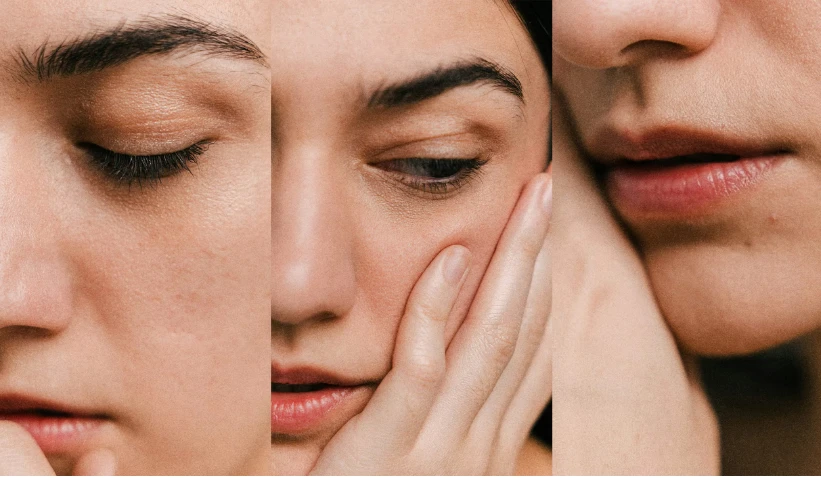 ارتباط سلامت روان و مراقبت از پوست - استرس چگونه سلامت پوست را تحت تأثیر قرار می‌دهد؟
